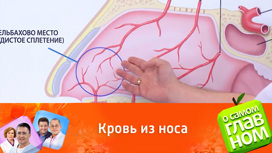 Кровотечения из носа: что надо знать