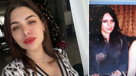 Молодая жена Константина Ивлева призналась в пластике носа