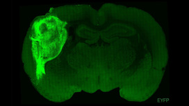 Органоид из клеток человеческого мозга, пересаженный в мозг крысы. Он был помечен флуоресцентным белком, поэтому на снимке светится зелёным.