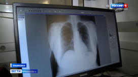 В регионе проходит акция по борьбе с туберкулезом "Дыши легко"
