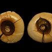 Пещерная стоматология: самая древняя зубная пломба была поставлена 13 тысяч лет назад