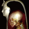 Трёхмерное КТ-изображение головы мумии Аменхотепа I. Видны составляющие слои: маска, голова мумии и окружающие повязки.
