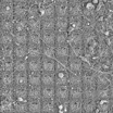 Нейронная культура росла более шести месяцев на многоэлектродной матрице. Изображение получено с помощью сканирующего электронного микроскопа.