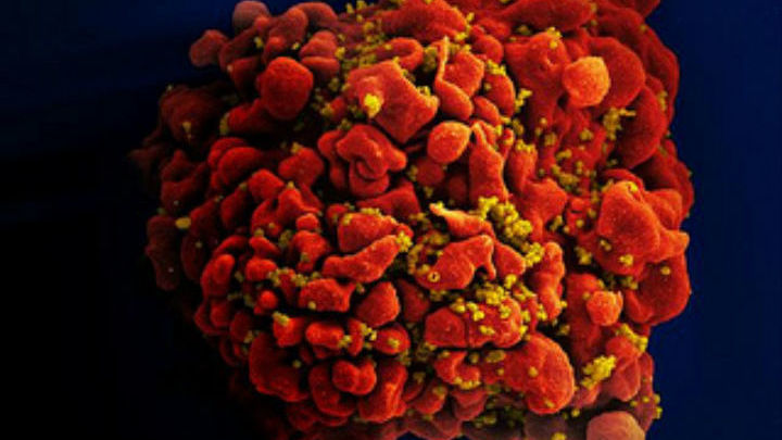 Фото инфицированной ВИЧ H9 T-клетки, снятое сканирующим электронным микроскопом.