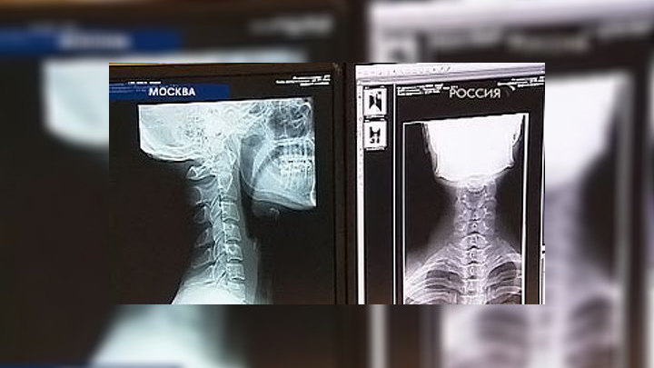 Томограф – враг рака и друг радиологов