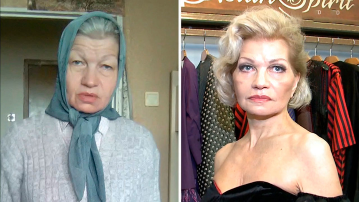 Жена гогена до и после операции фото