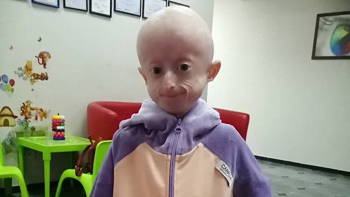 На Украине от старости умерла 10-летняя девочка