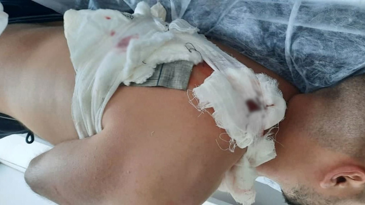 Фото: t.me/zheltyeslivy