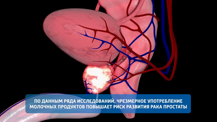 Мясников назвал продукт, который может повысить риск